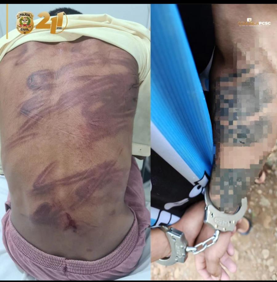 Polícia Civil Desvenda Crime Brutal de Tortura e Cárcere Privado em